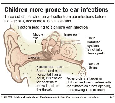 New technology optimizes ear infection diagnosis and management