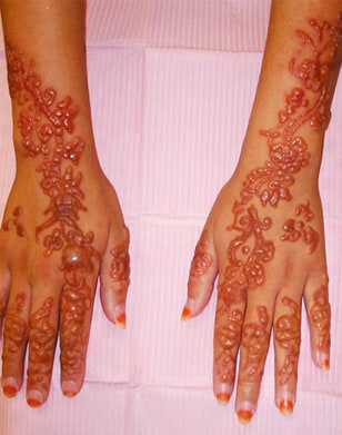 henna scar skin allergies hands chemicals chemical allergy cause reaction allergic dye harms warning effects hazard google plant hair mibba