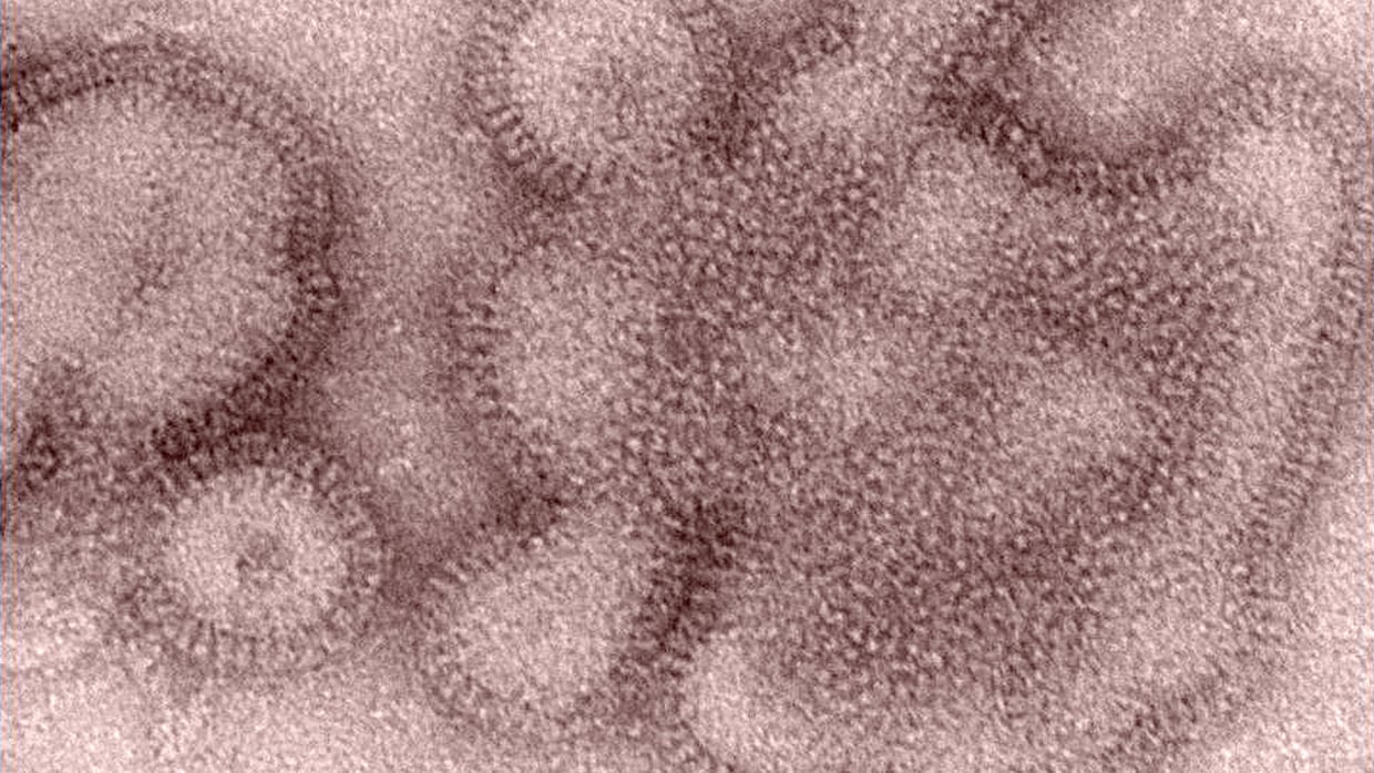 From H1N1 to H5N2, Whats in a Flu Name?