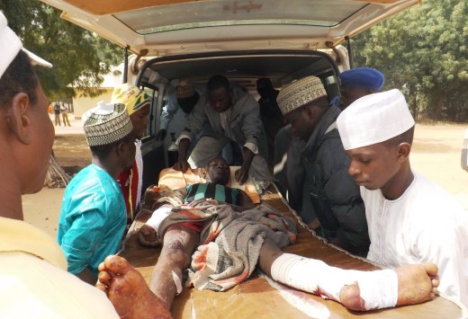 Image: A man injured in a suicide blast is transported by ambulancel in Potiskum, Nigeria, on Sunday