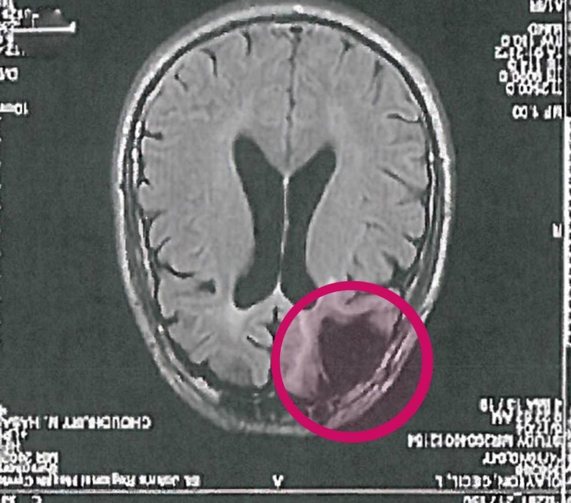 150316-brain-scan-mn-0820_0_57ca3d1e3d2d