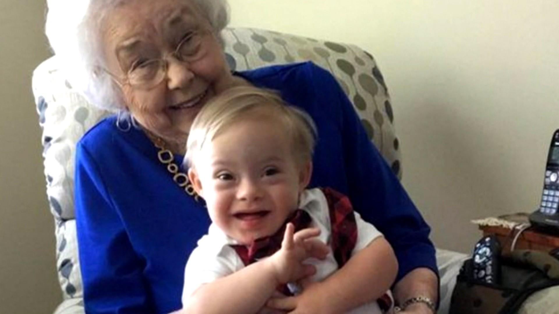 first gerber baby with down syndrome