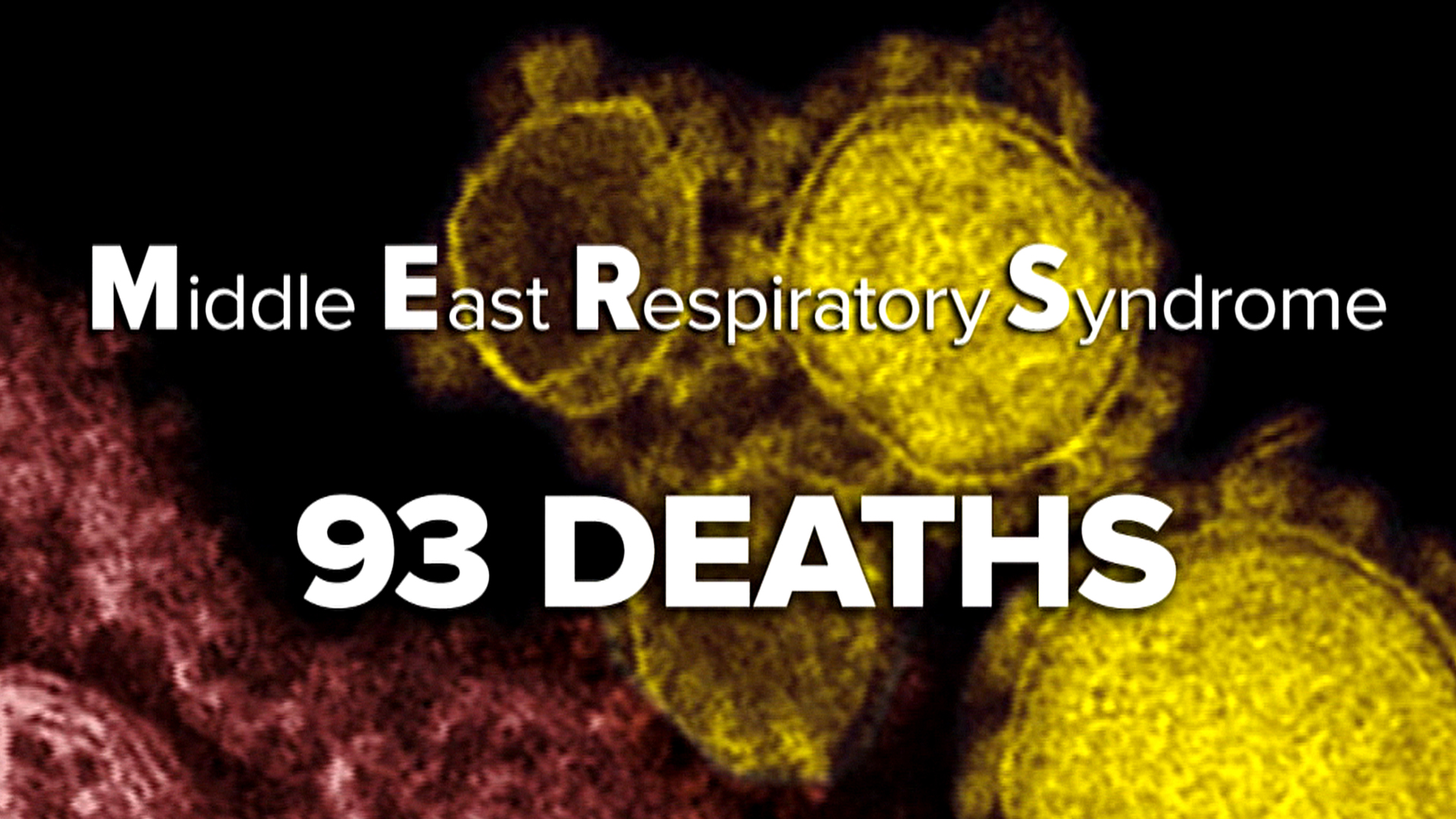 What is MERS? And Other Questions About the Outbreak1920 x 1080