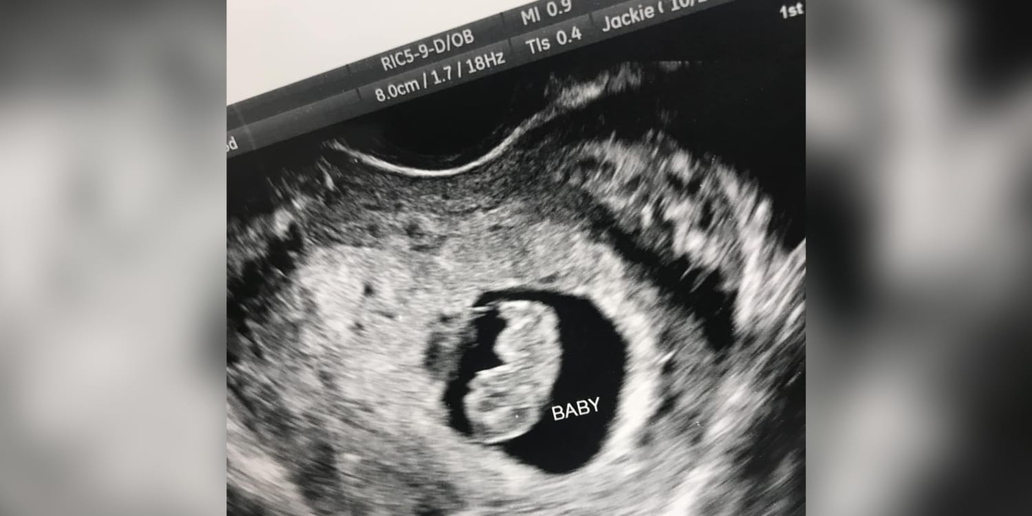 Best date for 6 weeks 4 days pregnant ultrasound heartbeat 2022