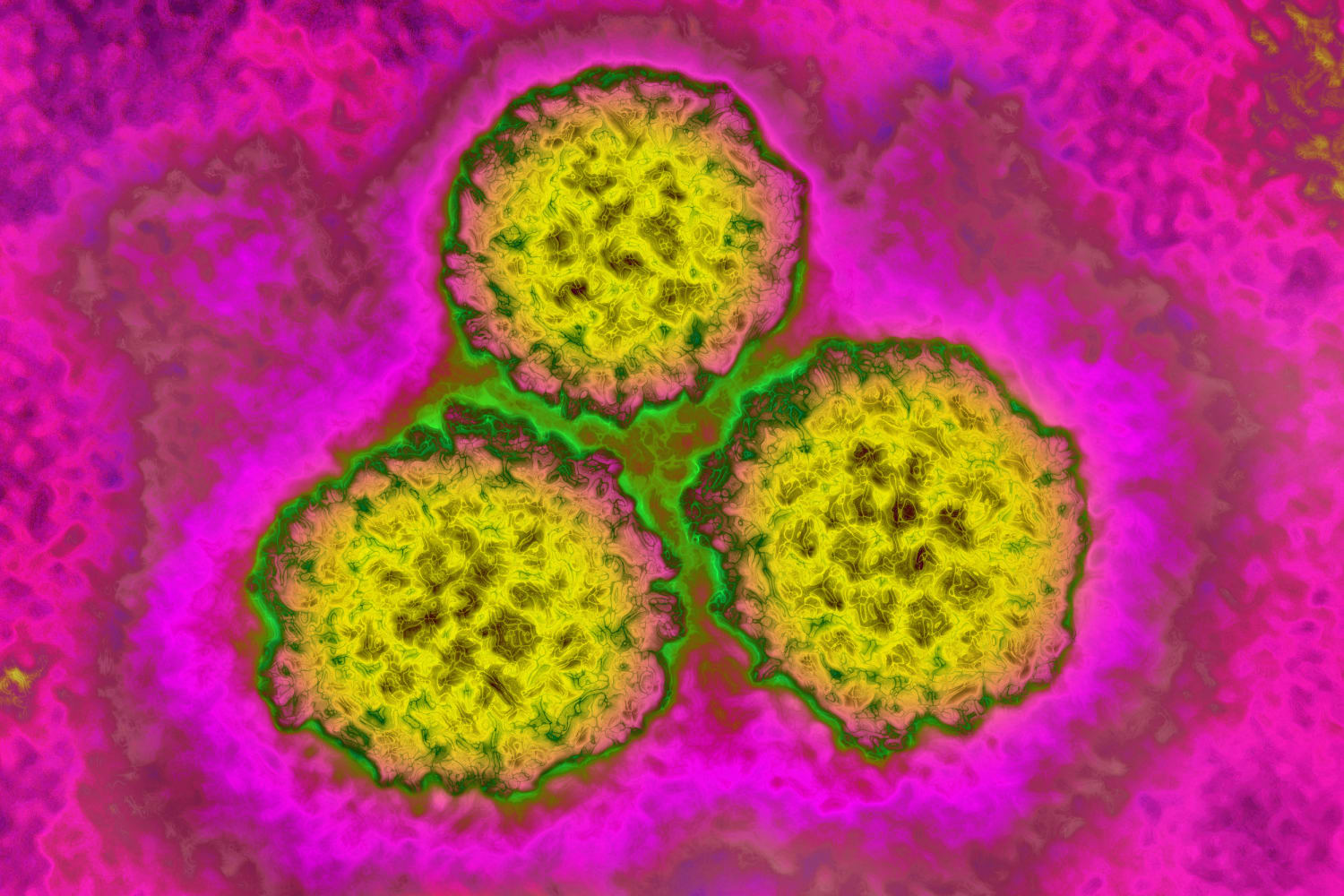 hpv cancer news