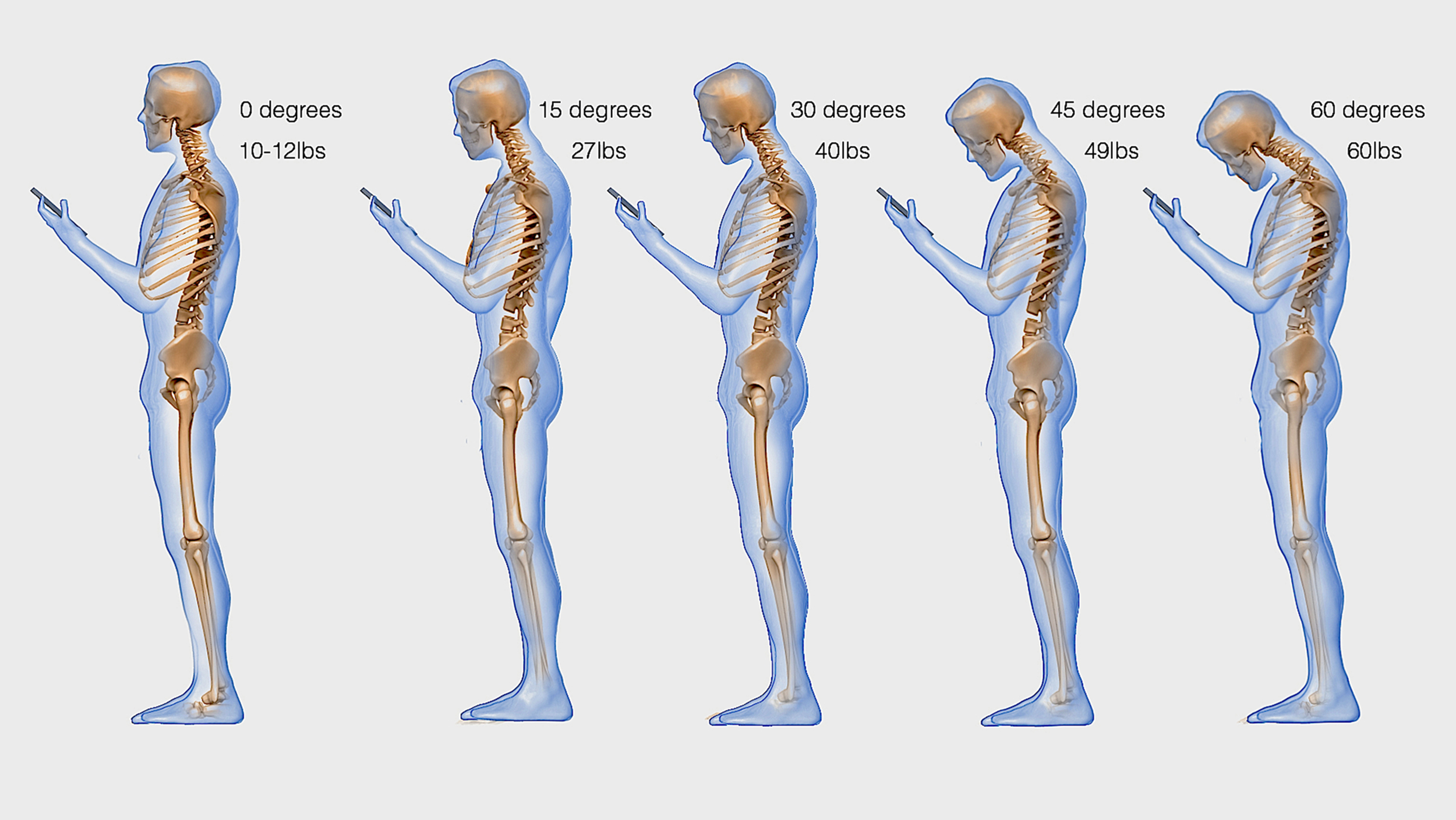 Texting neck: How hunching over your smartphone stresses 
