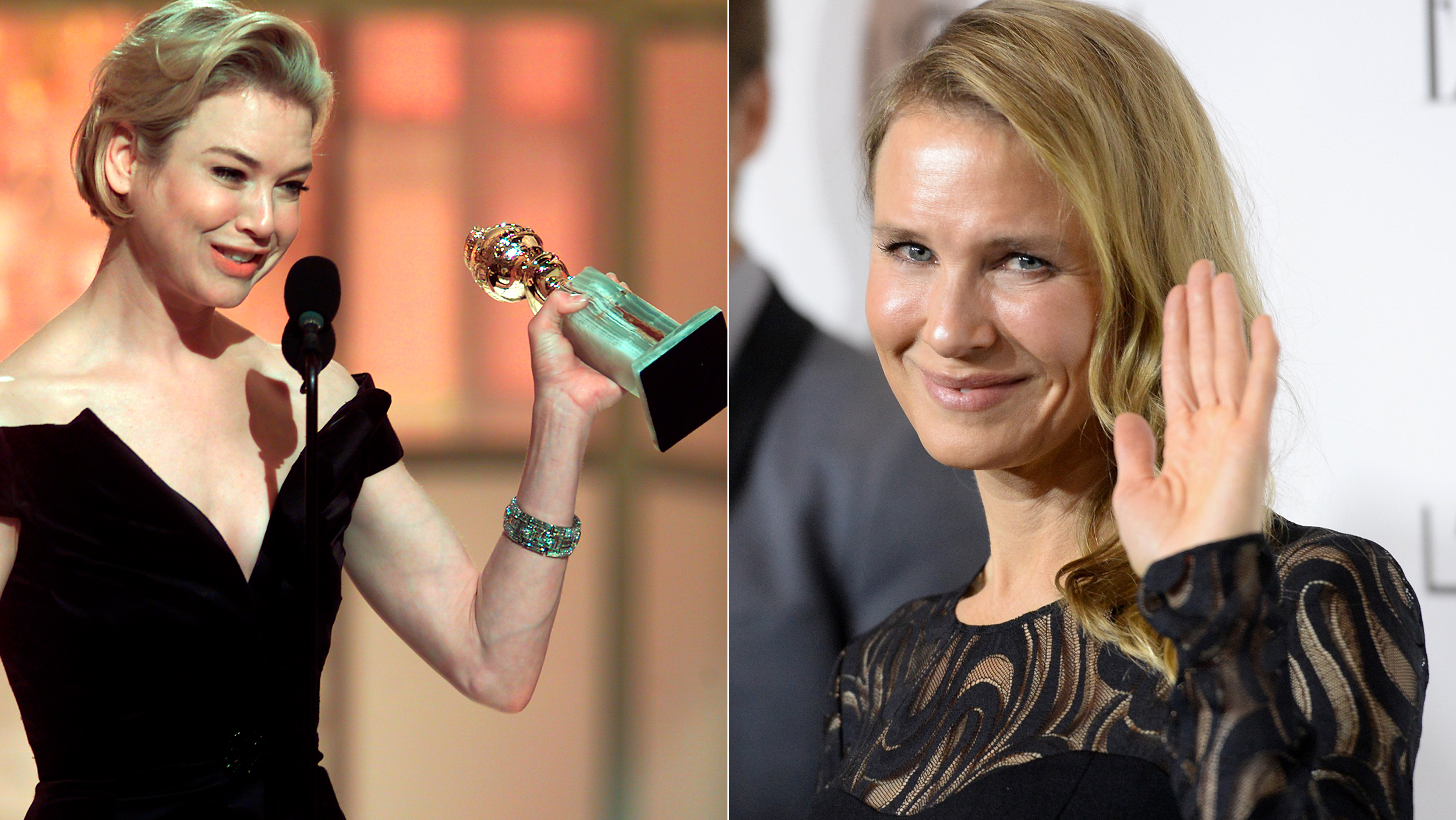 Renee Zellweger 'glad' people think she looks 'different' - TODAY.com