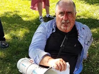 Bloodshed in D.C. as Violence Flares at Turkish Ambassador's Residence
