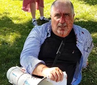 Bloodshed in D.C. as Violence Flares at Turkish Ambassador’s Residence