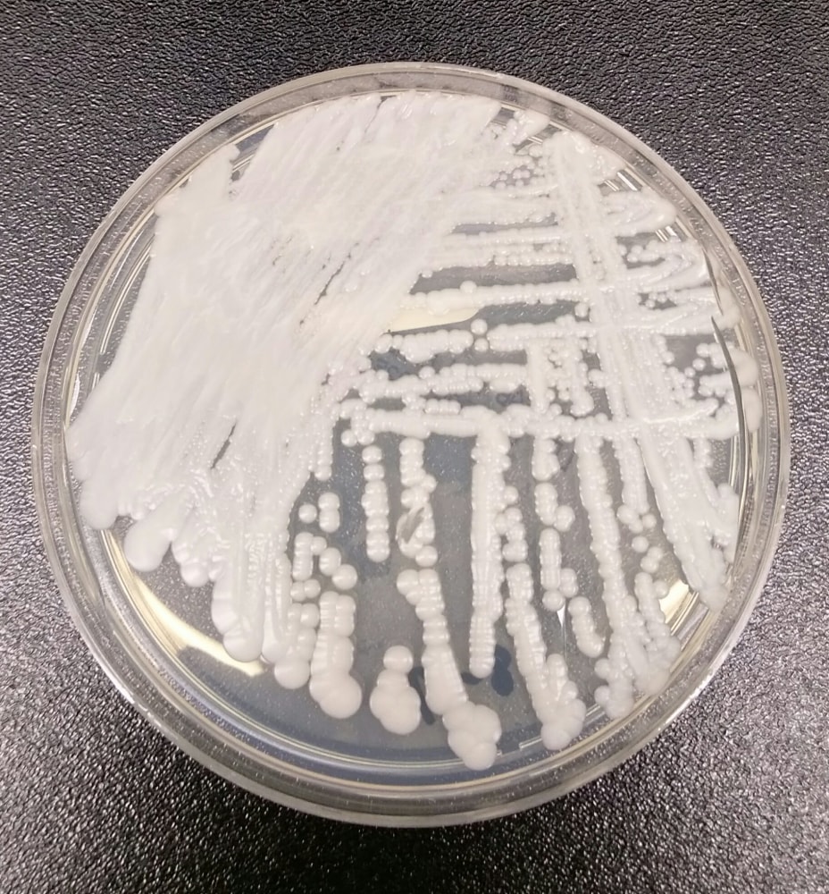 New Killer Fungus Found in U.S. Patients - NBC News