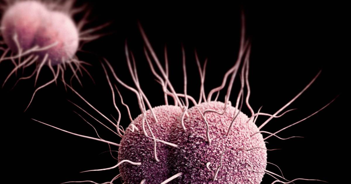 Nearly Untreatable Gonorrhea Spreading Globally