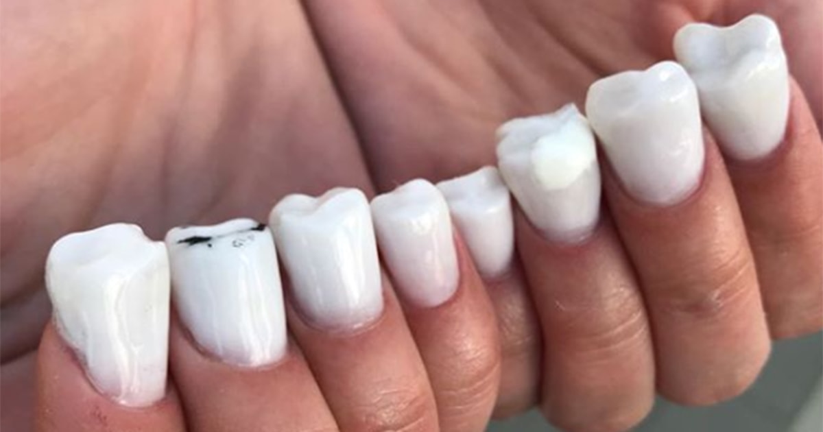Molar Nails Are The Creepy New Nail Trend Taking Over Instagram