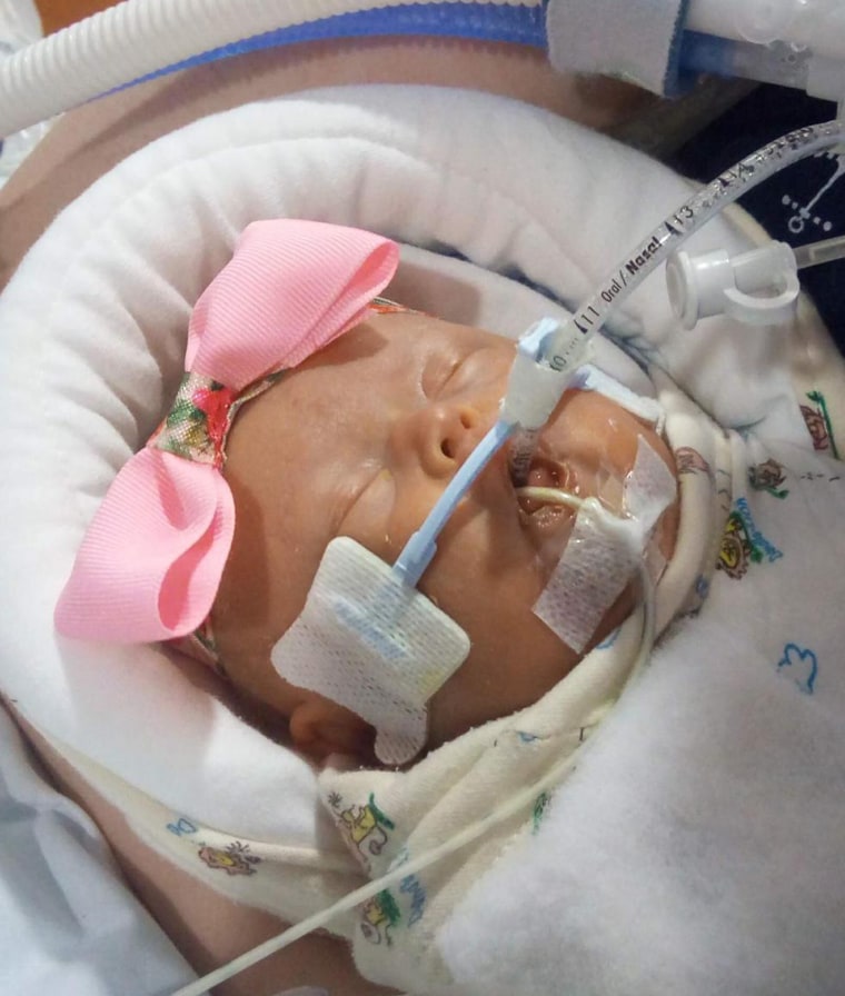 Bébé fille micropremie à l'unité de soins intensifs néonatals