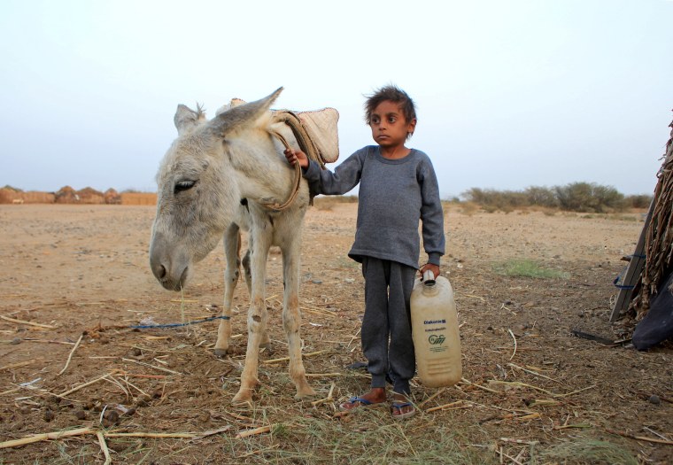 Image: Yemeni boy fights malnutrition as hunger stalks nation's children