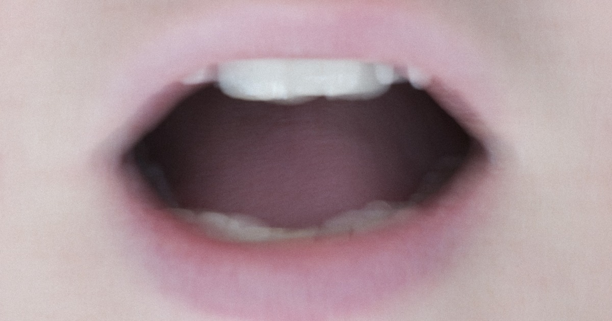 ‘Covid tongue’ could be another symptom of the coronavirus, the British researcher suggests
